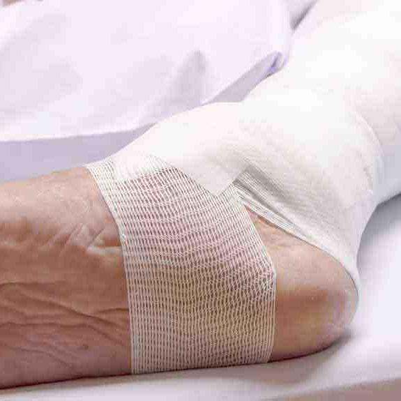 Pressure Ulcer New 14931587